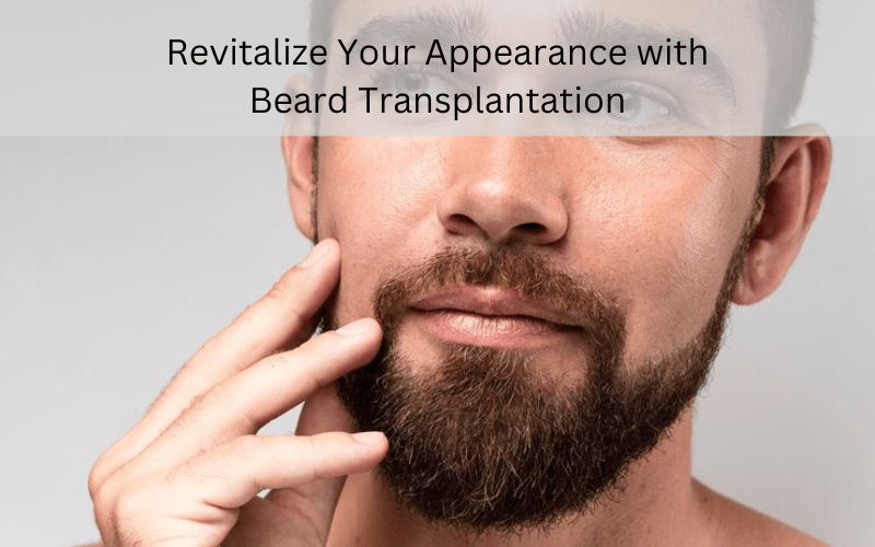 Beard transplantation