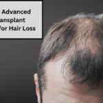 hair transplant solutions