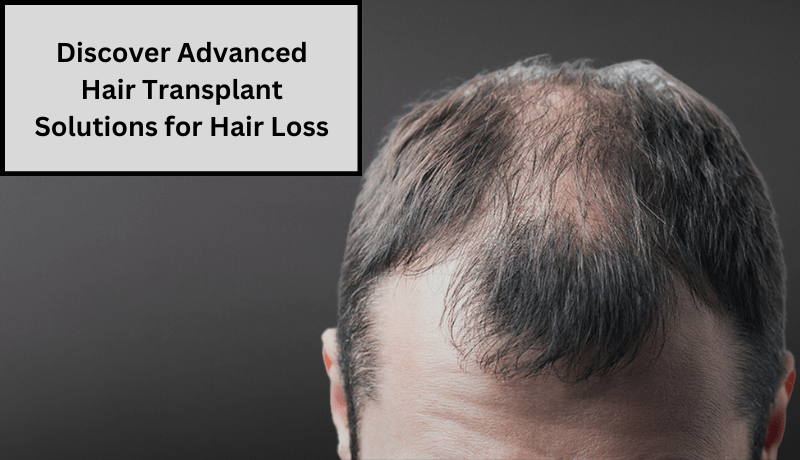 hair transplant solutions