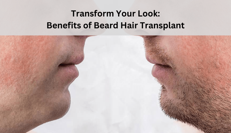 Beard hair transplant Benefits